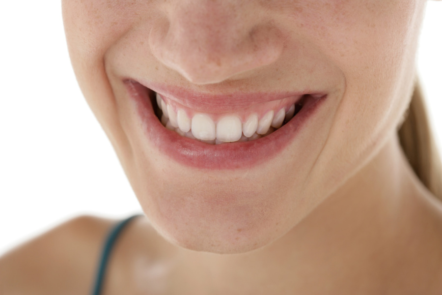 Zahnfarbe natürliche Zahnfüllungen